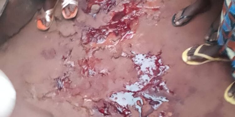 Insécurité à Mbujimayi : un homme abattu par des inconnus à Bipemba