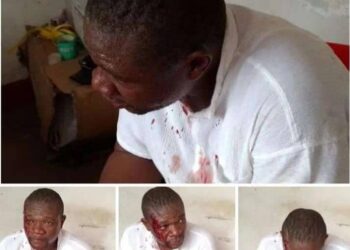 Mbujimayi : le candidat député national Médard Dieya wa Dieya tabassé au centre de vote par des personnes non identifiées