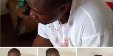 Mbujimayi : le candidat député national Médard Dieya wa Dieya tabassé au centre de vote par des personnes non identifiées