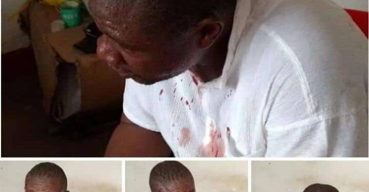 Mbujimayi : le candidat député national Médard Dieya wa Dieya tabassé au centre de vote par des personnes non identifiées