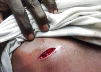 Santé : distribution des moustiquaires à Kinshasa, des agents de la santé attaqués à Kisenso et à Makala par des Kuluna