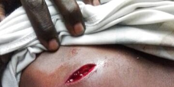 Santé : distribution des moustiquaires à Kinshasa, des agents de la santé attaqués à Kisenso et à Makala par des Kuluna