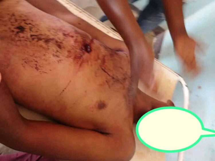 Lubumbashi : Un militaire de la garde républicaine ôte la vie à un combattant de l&rsquo;UDPS au Quartier Kisanga (témoins)