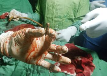 Kasaï-Oriental : deux blessés par balles dans un affrontement entre Bena Nshimba et Bena Muembia