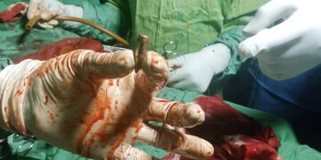 Kasaï-Oriental : deux blessés par balles dans un affrontement entre Bena Nshimba et Bena Muembia