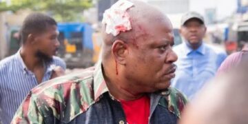 RDC : Violences lors d’un meeting de Jean-Marc Kabund à Kinshasa, plusieurs blessés, l’opposant touché à la tête