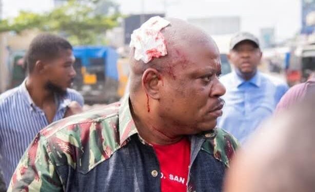 RDC : Violences lors d’un meeting de Jean-Marc Kabund à Kinshasa, plusieurs blessés, l’opposant touché à la tête