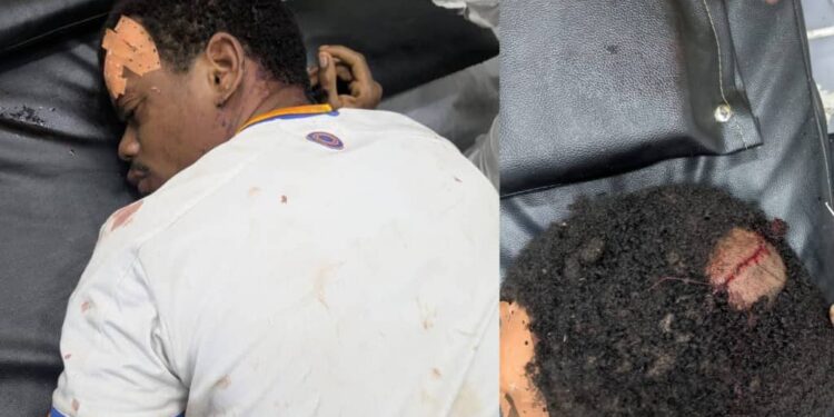 Kisangani : Christian Pendeza grièvement blessé par les gardes d&rsquo;un magistrat militaire, une plainte déposée