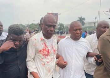 RDC : heurts lors du sit-in de l’opposition, Fayulu et Sesanga blessés
