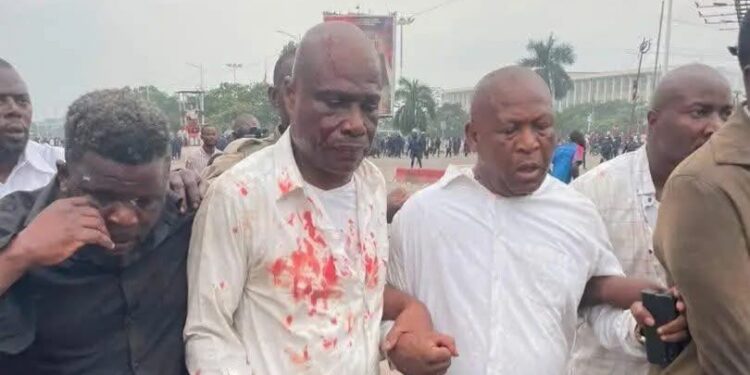 RDC : heurts lors du sit-in de l’opposition, Fayulu et Sesanga blessés