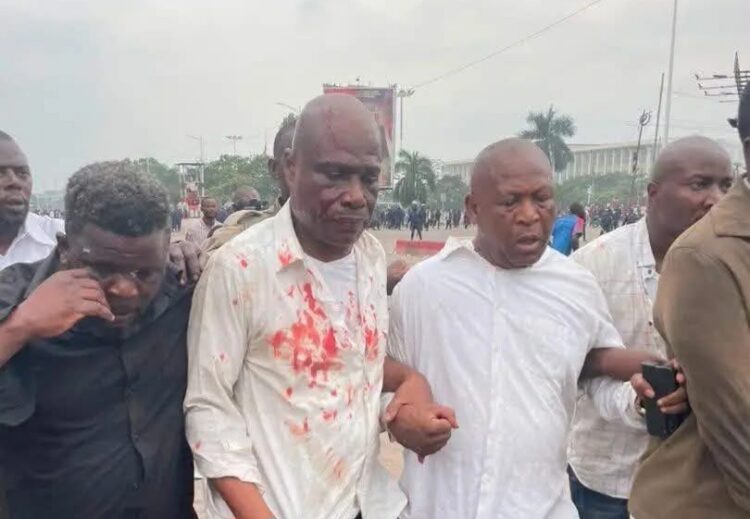 RDC : heurts lors du sit-in de l’opposition, Fayulu et Sesanga blessés